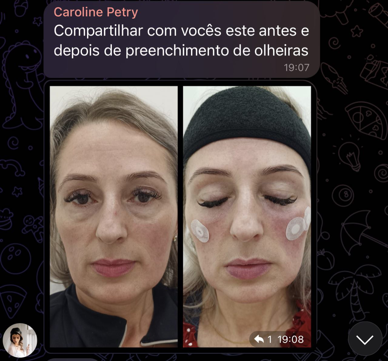 Caroline Petry